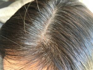 神の根本に白髪