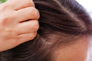 白髪が目立つ髪の根本